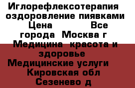 Иглорефлексотерапия, оздоровление пиявками › Цена ­ 3 000 - Все города, Москва г. Медицина, красота и здоровье » Медицинские услуги   . Кировская обл.,Сезенево д.